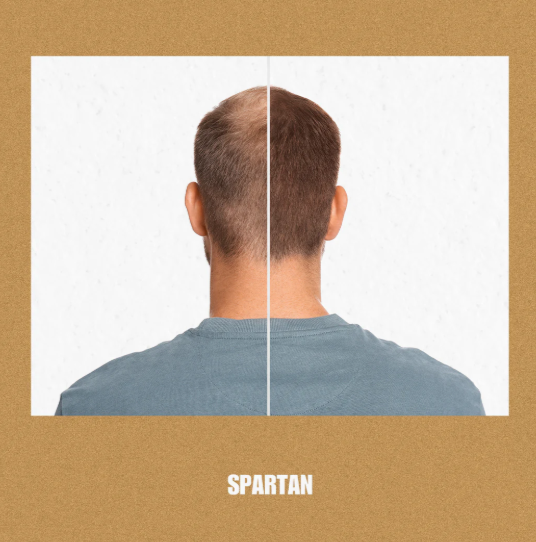 Hair Regrowth Comparison