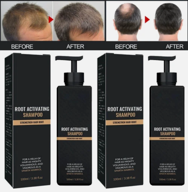 Spartan Hair Regrowth Products